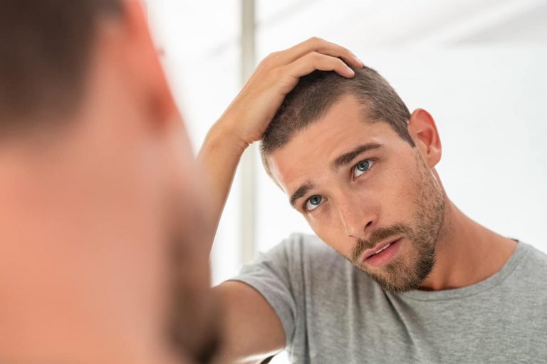 50 Best Hairstyles for Receding Hairlines (2023 Updated)