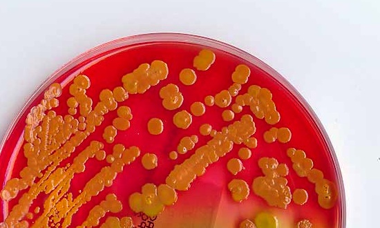 New Sex “Superbug” – Quick Facts